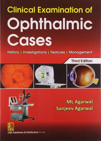 Book cover number 1 for Clinical Examination Of Ophthalmic Cases written by M. L. Agarwal, Sanjeev Agarwal published by CBS Publishers & Distributors Pvt. Ltd.