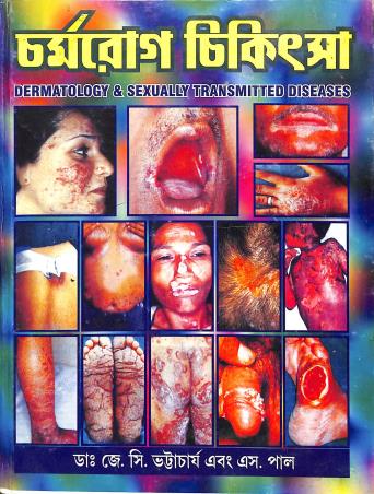 Book cover number 1 for Charmarog Chikitsha written by J. C. Bhattacharya, S. Paul published by Paul Medico