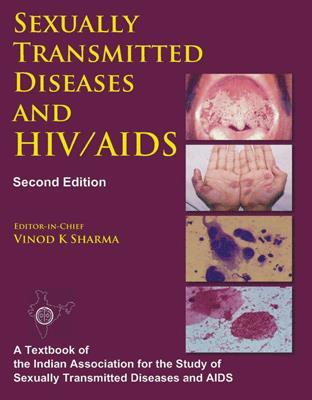 Book cover number 1 for Sexually Transmitted Diseases And HIV / AIDS written by Vinod K. Sharma published by Viva Books Private Limited