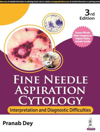 Book cover number 1 for Fine Needle Aspiration Cytology : Interpretation And Diagnostic Difficulties written by Pranab Dey published by Jaypee Brothers Medical Publishers (P) Ltd.