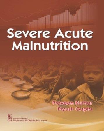 Book cover number 1 for Severe Acute Malnutrition written by Praveen Kumar, Piyush Gupta published by CBS Publishers & Distributors Pvt. Ltd.